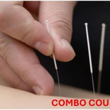 Functional Integrated Needling LEVEL 1&2 COMBO- West Palm Beach, FL - March 6-8 AND March 27-29, 2026
