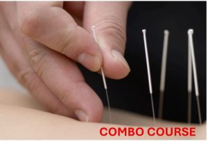 Functional Integrated Dry Needling LEVEL 1&2 COMBO- Kingston ON - Aug 1-2 and Aug 15-16, 2026